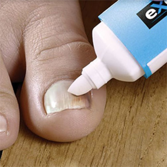 Excilor Pen - Nail Fungal Infection Treatment