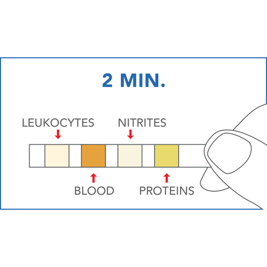 Urinary Tract Infections Test by Prima Home Test